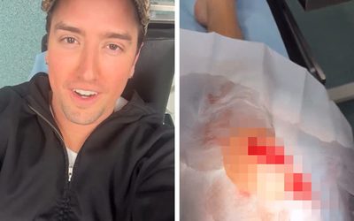 Big Time Rush-ի Լոգանը շտապեց հիվանդանոց՝ բեմում բաց ծունկը կտրելուց հետո, տես նկարը