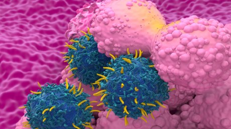 Նորարար ռազմավարություն կրծքագեղձի քաղցկեղի ամենատարածված տեսակների դեմ