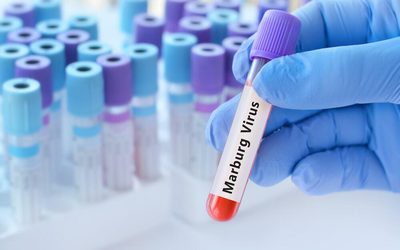 Եթովպիայում Մարբուրգի վիրուսային վարակի համաճարակ է բռնկվել