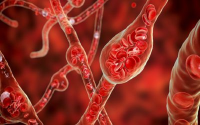 Արյան ճնշման հին, հայտնի դեղամիջոցը կարող է սահմանափակել գլխուղեղի չարորակ ուռուցքների աճը