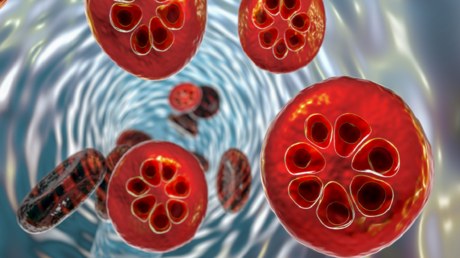 Տասնամյակների լճացումից հետո. Մալարիայի դեմ նոր բուժումն ավետում է հիվանդության դեմ պայքարում լուրջ առաջընթաց