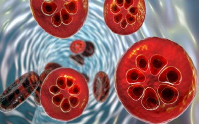 Տասնամյակների լճացումից հետո. Մալարիայի դեմ նոր բուժումն ավետում է հիվանդության դեմ պայքարում լուրջ առաջընթաց